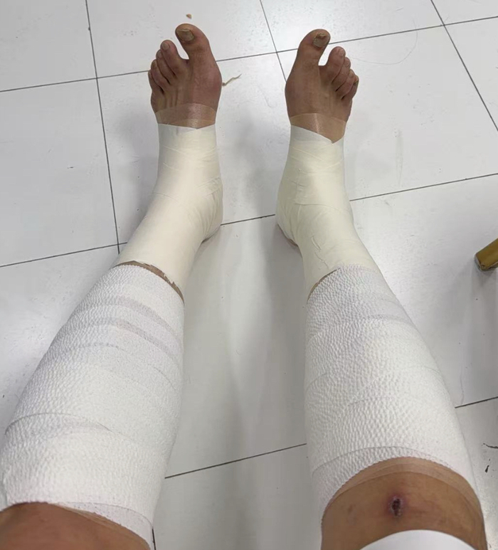 开云体育app-胜山西谁注意翟晓川赛后伤势？双腿拉伤绑满绷带，看着都残忍！|北京|篮板|比赛|王治郅|复出_新浪体育_新浪新闻